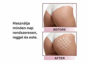 ÚJDONSÁG! <br>„Kerek popsi” <br>Fenékemelő & feszesítő krém 4 BioContour fenékfeszesítő krém,fenékemelő krém Intenzív, azonnali feszesítő hatás Minősített natúrkozmetikum Egyedisége: Prémium minőségű, hatóanyagokban gazdag fenékemelő és feszesítő krém, amely segíti a bőr rugalmasságának és fiatalos megjelenésének megőrzését. Seafill tengeri ferment, peptidek és niacinamid kombinációja azonnali simító és feszesítő hatást nyújt, miközben a hialuronsav, a kollagén és a Centella (tigrisfű) kivonat hozzájárul a bőr teltségéhez és erősíti a lifting hatást. Gyömbér- és a növényi botoxként ismert acmella- kivonat tartalma együttesen fokozzák a bőr feszesebb, üdébb megjelenését. Frissítő mangó illattal kényeztet. Könnyű, gyorsan felszívódó formula mindennapos használatra, minden bőrtípusra. Használat: A hatékonyság növelése érdekében használat előtt radírozza le a bőrét. Körkörös mozdulatokkal masszírozza be a krémet a fenék területén. Használja minden nap rendszeresen, reggel és este. Variáns: minden bőrtípusra, nem tartalmaz szintetikus illatanyagot Kiszerelés: 150 ml (73,30 Ft / 1ml)